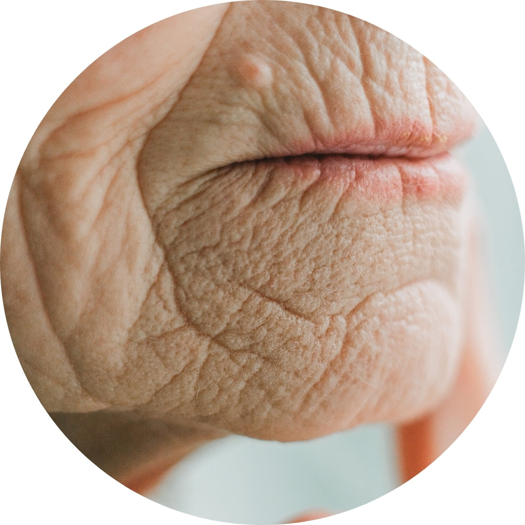 Anti-Falten Starter Set - Glowholic Micro-Needling Infusion für zuhause