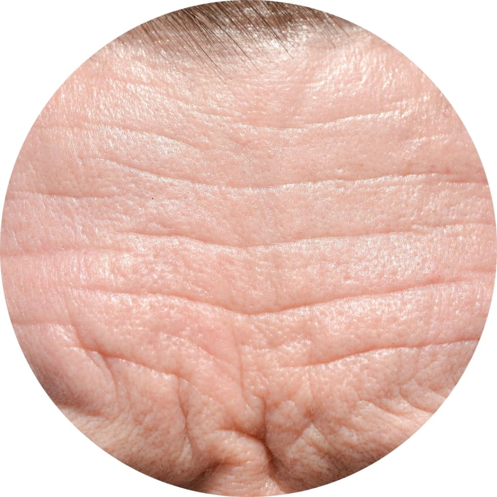 Anti-Falten Starter Set - Glowholic Micro-Needling Infusion für zuhause