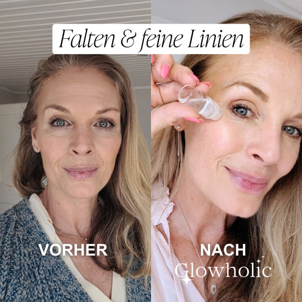 Anti-Falten Starter Set - Glowholic Micro-Needling Infusion für zuhause
